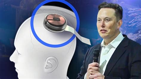 implant rfid chip brainwash|Elon Musk's Neuralink has put in its first human brain implant : NPR.